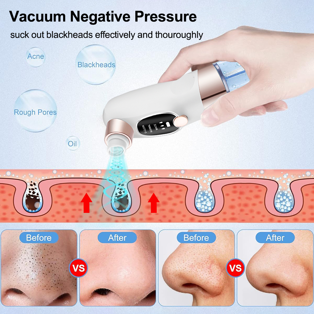 Blackhead Remover Electric Bla - Air Bubble Remover reseña y precio